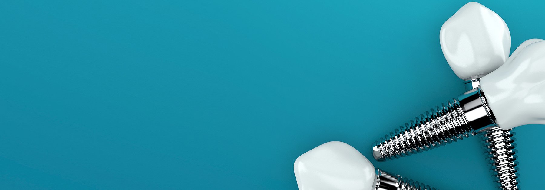 İmplamarkt Yakında Yayında Değil mi?